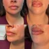 The Subtle Beauty Philosophy at Eternia Medspa