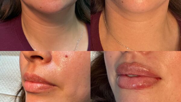 The Subtle Beauty Philosophy at Eternia Medspa